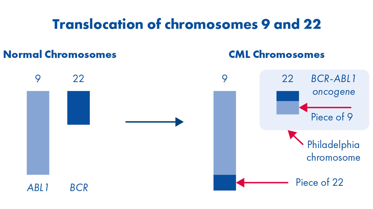 What causes CML?