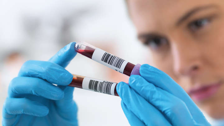 liquid biopsy