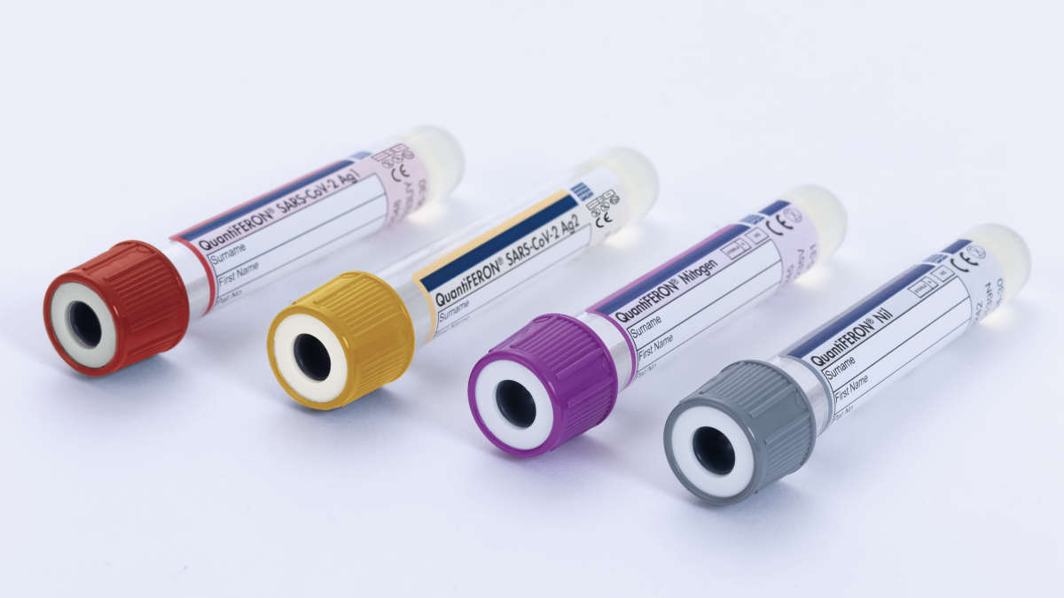 Trusted QuantiFERON technology