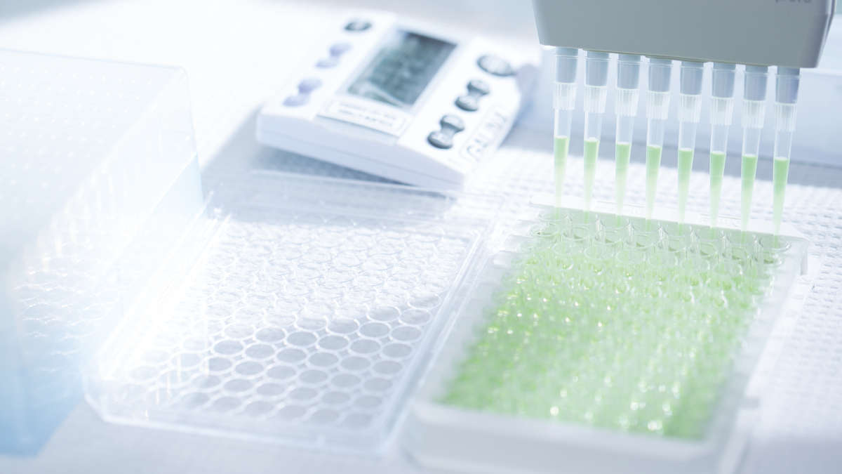 QuantiFERON, Control Panel