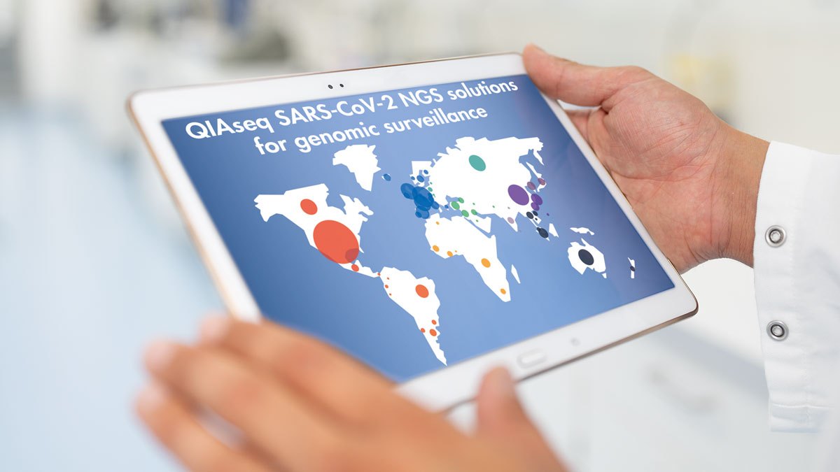 SARS-CoV-2 whole genome sequencing