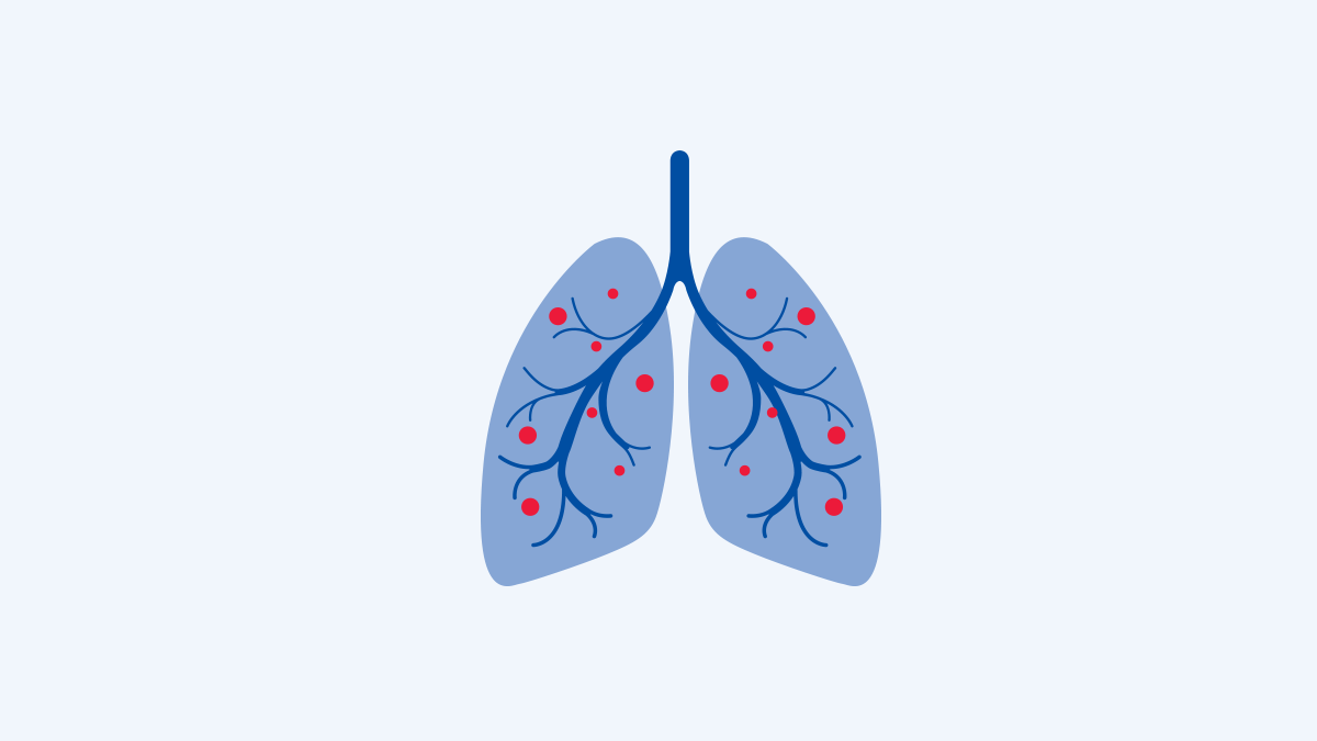 Panels respiratory illustration