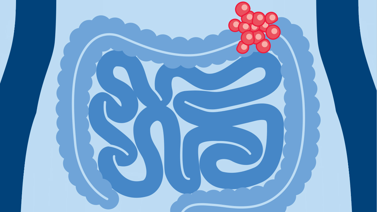 Specific results your oncologists can trust