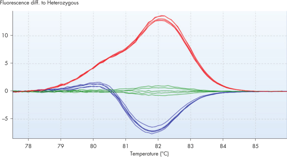 Q-Rex HRM Analysis Plug-in 1.0