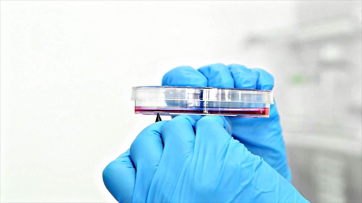 hands in blue gloves marking petri dish