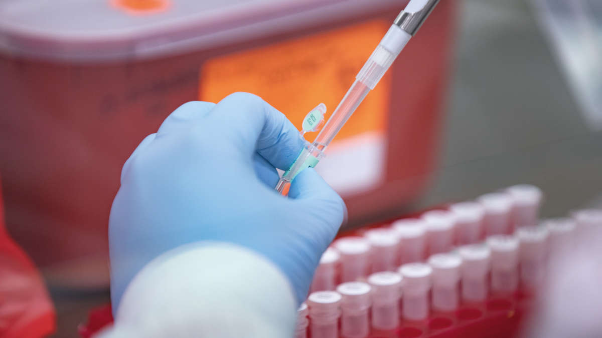 Companion Diagnostic (CDx)