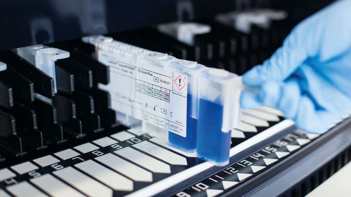 Tuberculosis management, QFT, LIAISON QuantiFERON-TB Gold Plus, In collaboration with DiaSorin, LIAISON XL analyzer, QFT tubes in rack