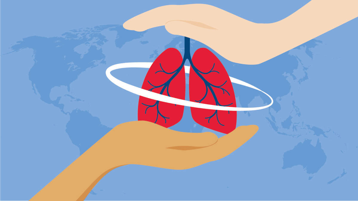 TB is a major public health issue affecting millions of people worldwide, and it can significantly impact healthcare systems and economies. 