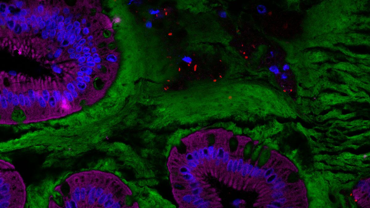 intestinal microbiota