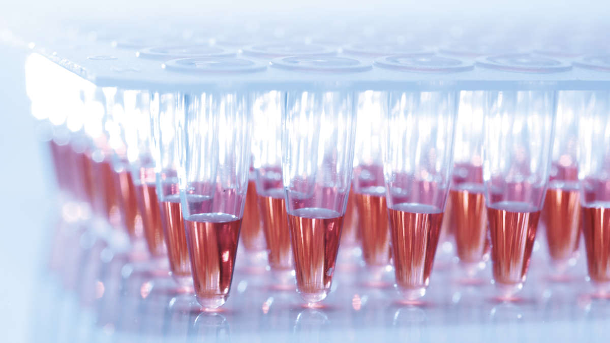 Amplification products visualized using CoralLoad PCR Buffer