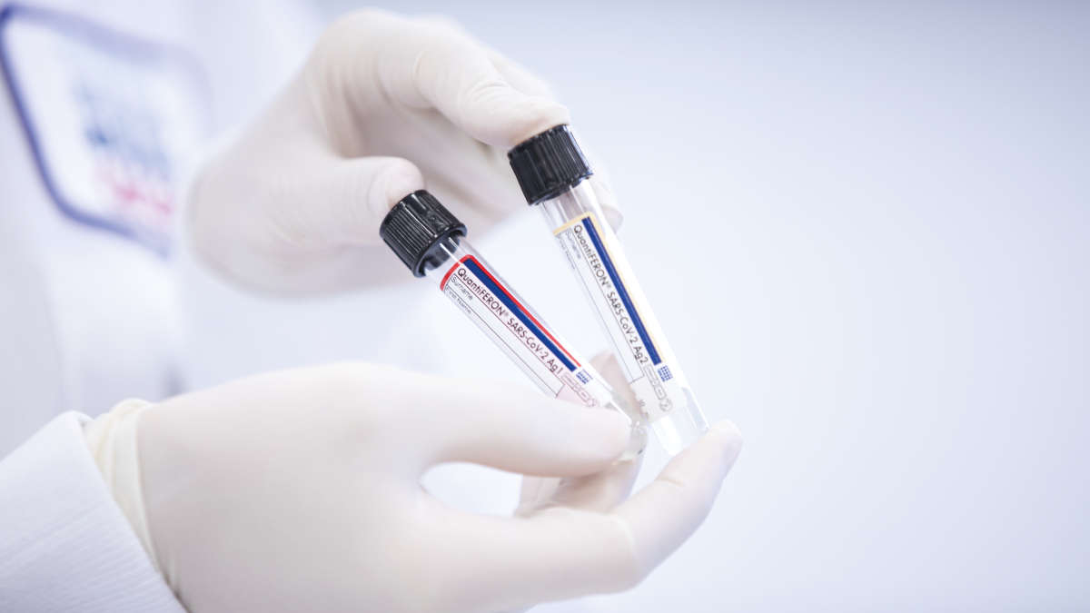 QFT, QuantiFERON, tubes