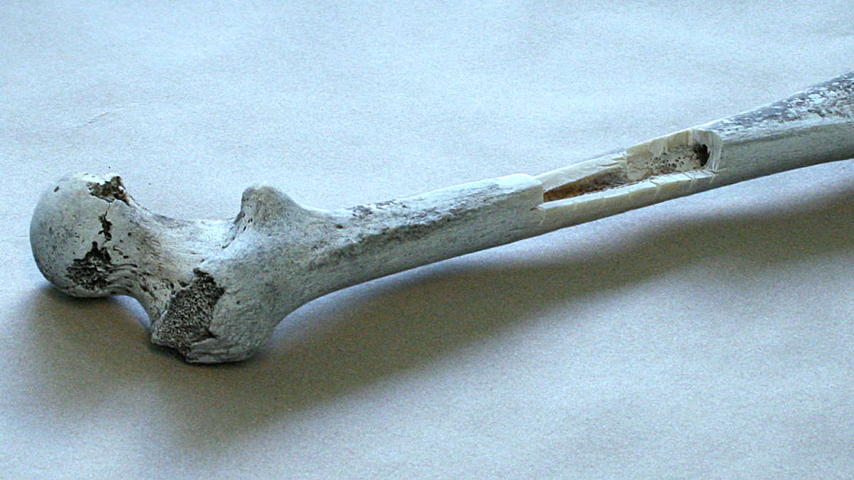 customer story, Rachel Oefelein, chief scientific officer, DNA Labs International, bone